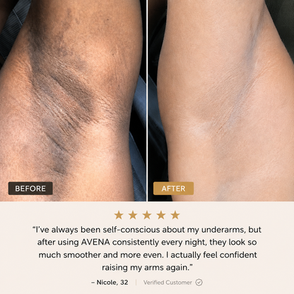 Exfoliating Hyperpigmentation Serum