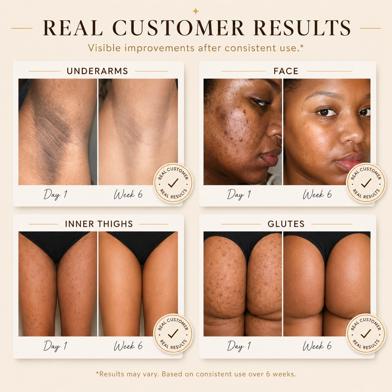 Exfoliating Hyperpigmentation Serum