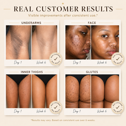 Exfoliating Hyperpigmentation Serum