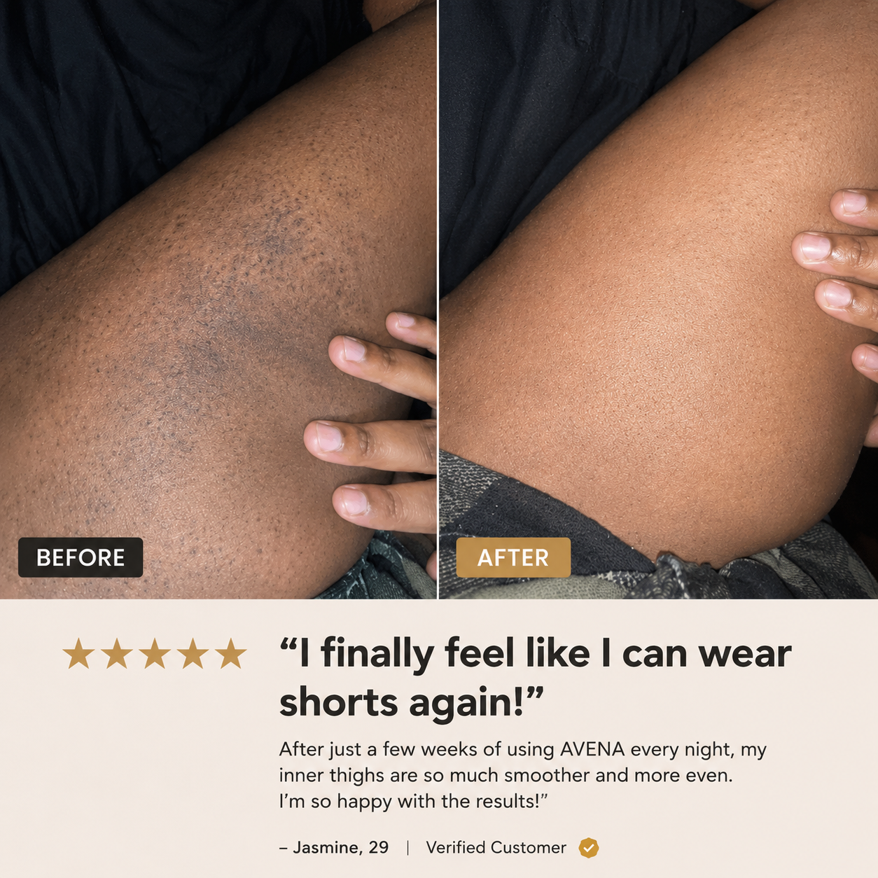 Exfoliating Hyperpigmentation Serum