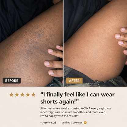 Exfoliating Hyperpigmentation Serum